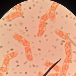 Zygophlebia eminens