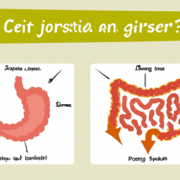 Gastrit